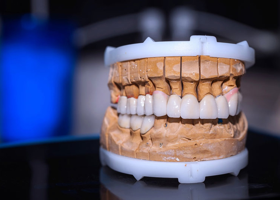 Full Arch Dental Implant Dentist Jacksonville Florida